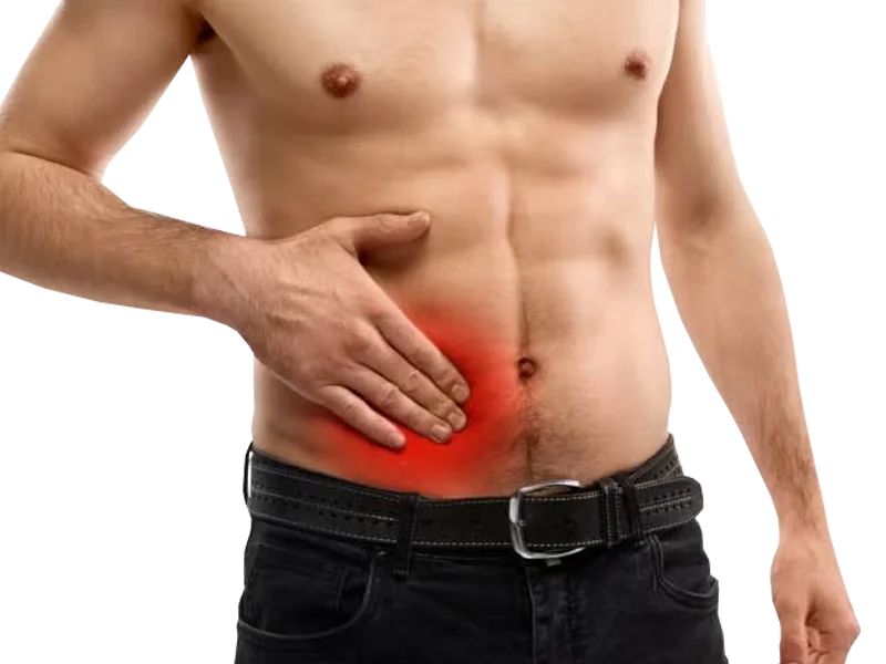 Hernia de Spiegel - Hernia Especialistas El Salvador